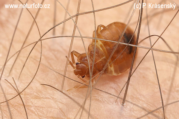 Bedbug (Cimex lectularius)