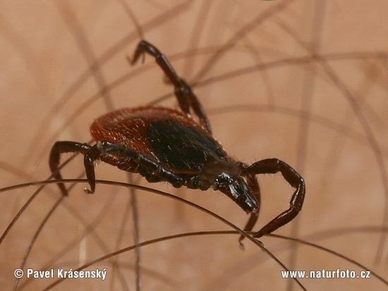 Ixodes ricinus