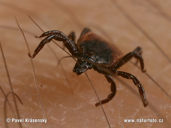 Ixodes ricinus