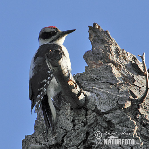 پکوایڈس ولوسس